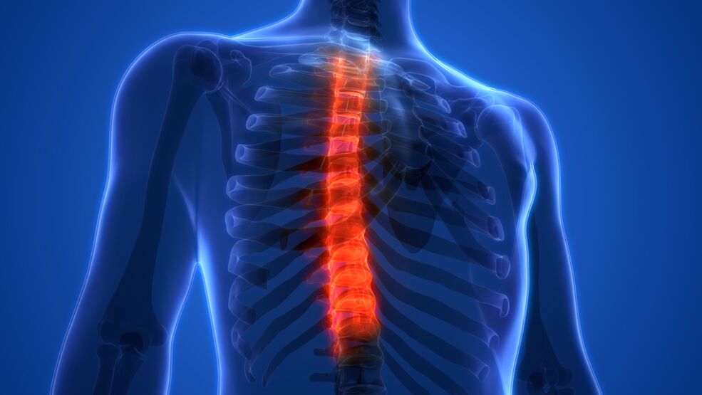 osteocondrosis de la columna torácica