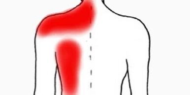 dolor debajo del omóplato izquierdo desde la espalda